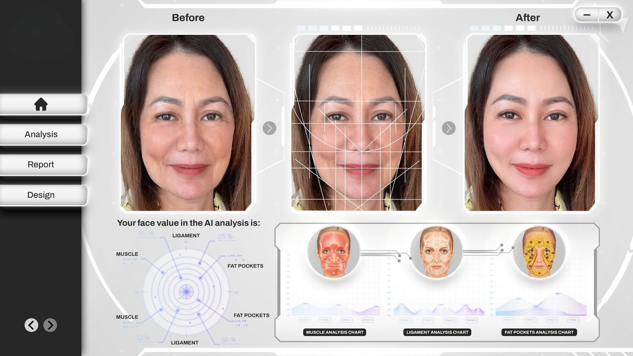 Tâm sự DAO KÉO 2